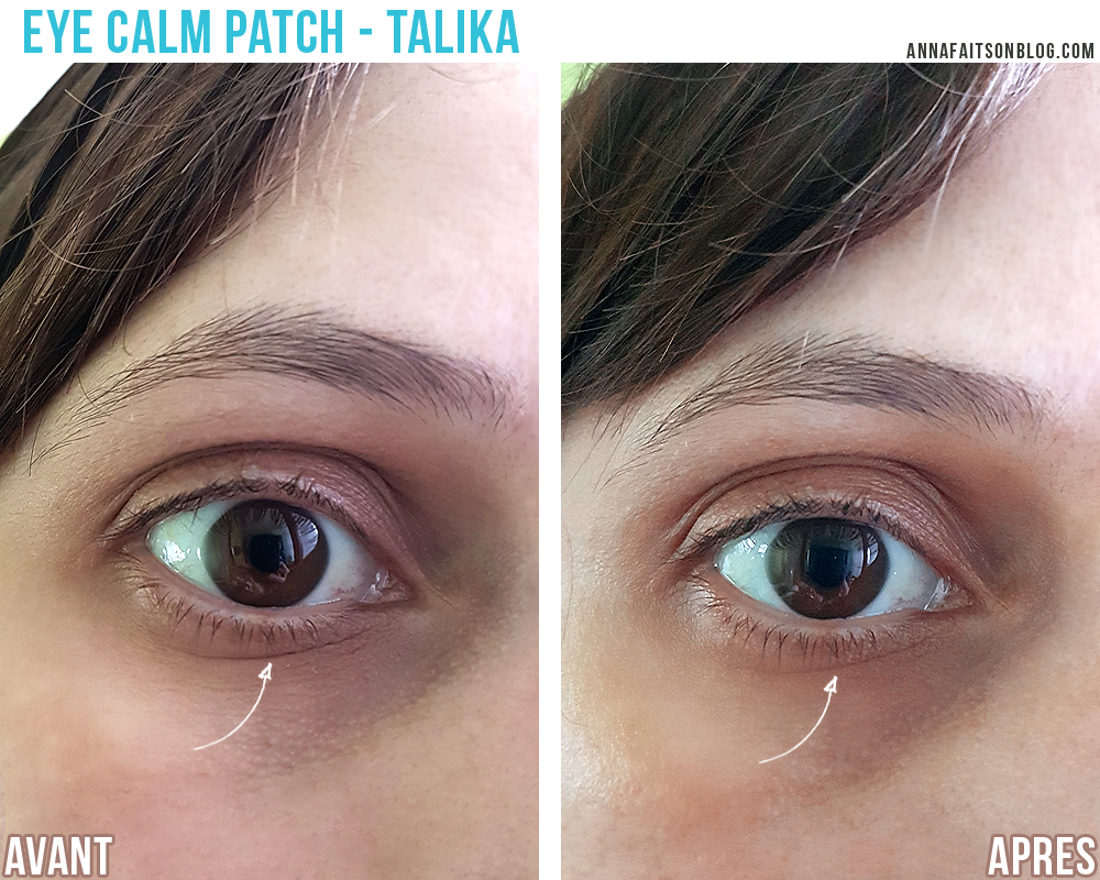 Eye Calm Patch Talika